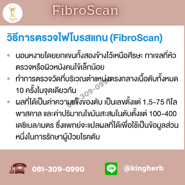 ไขมันเกาะตับ