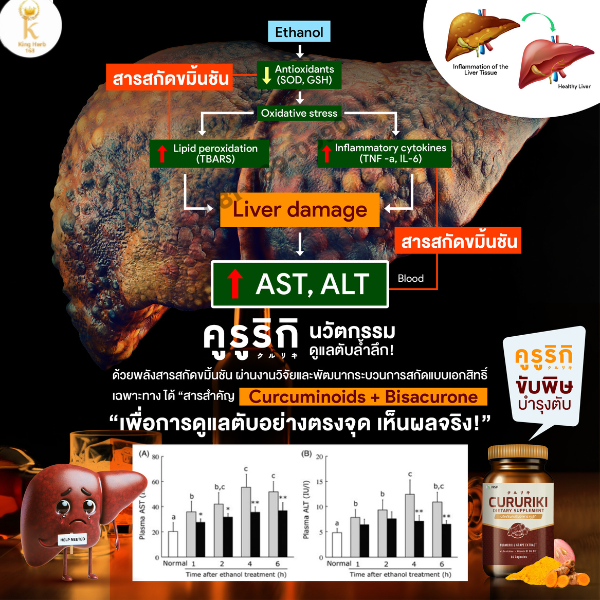 ไขมันเกาะตับ