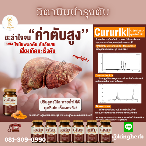ไขมันเกาะตับ