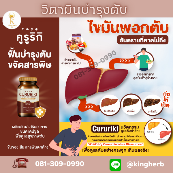 ไขมันเกาะตับ