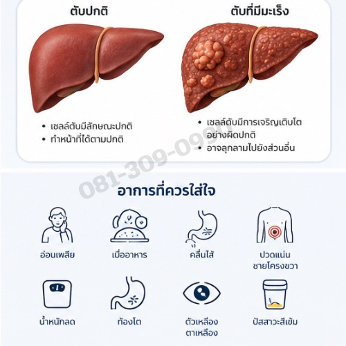 อาการมะเร็งตับ