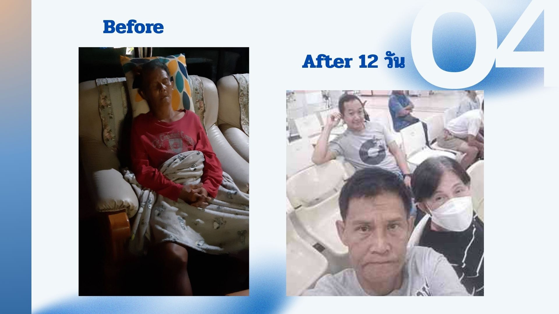 รีวิวผู้ป่วยโรคตับแข็ง