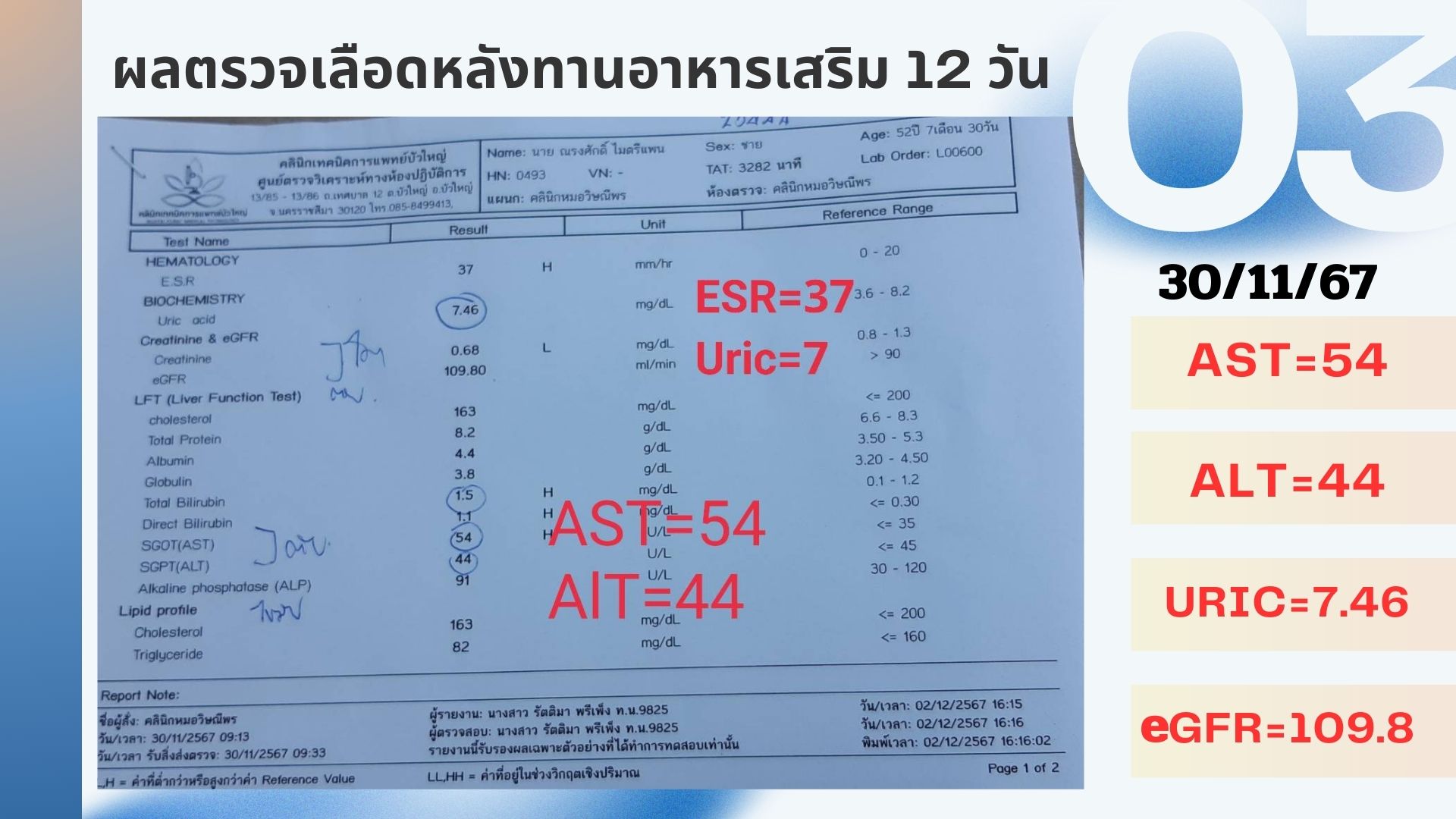 รีวิวผู้ป่วยโรคตับแข็ง