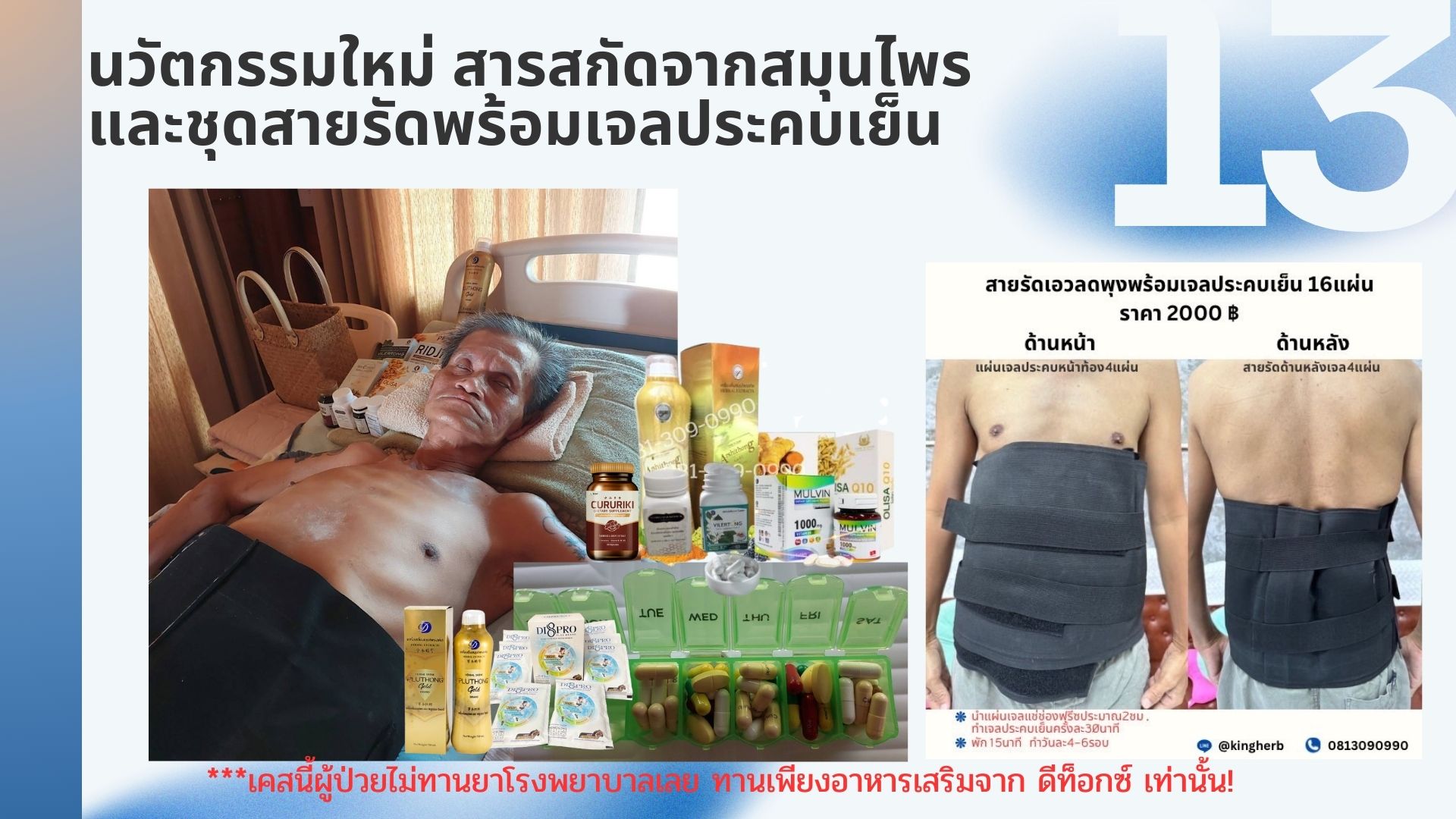 รีวิวผู้ป่วยโรคตับแข็ง รีวิวผู้ป่วยโรคตับแข็ง