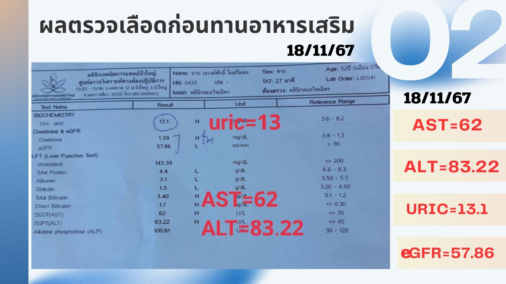 รีวิวผู้ป่วยโรคตับแข็ง