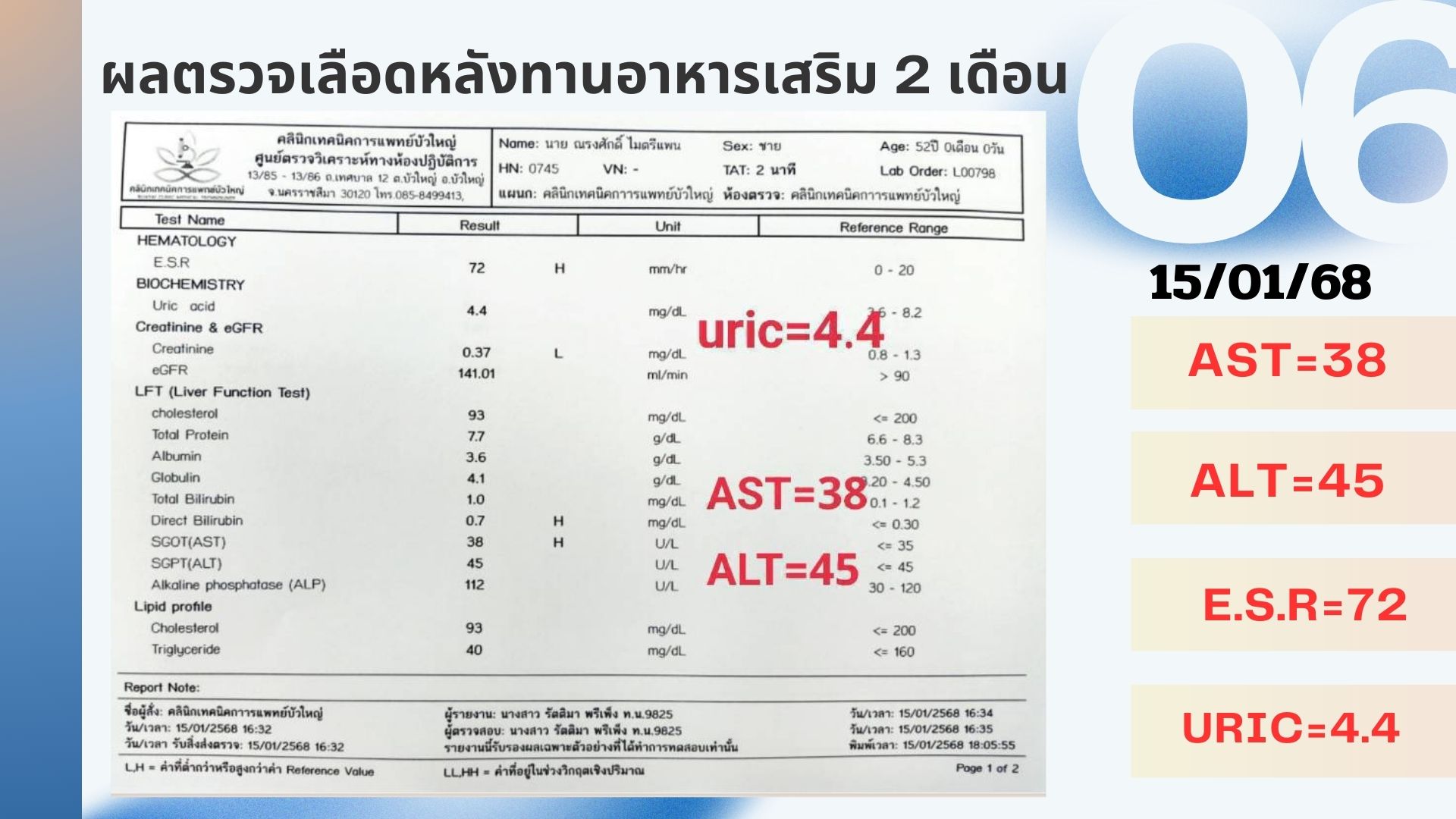รีวิวผู้ป่วยโรคตับแข็ง