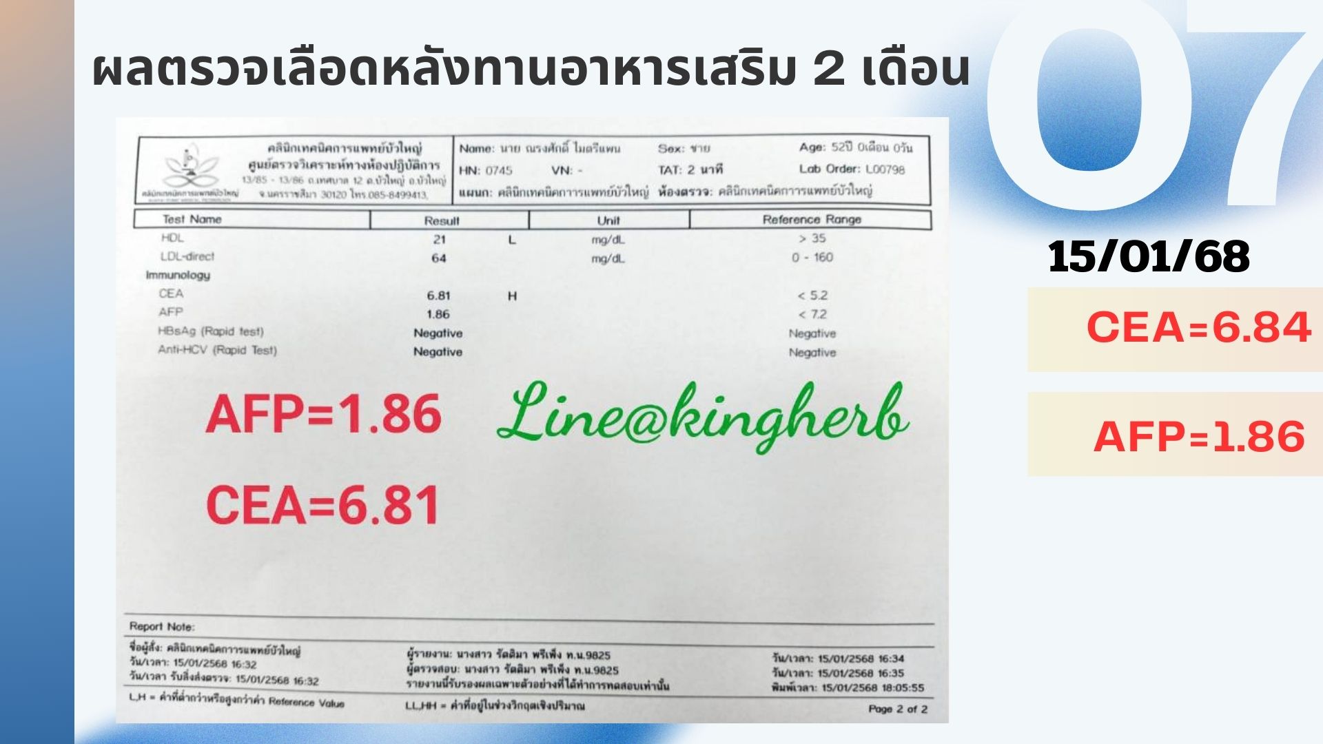 รีวิวผู้ป่วยโรคตับแข็ง