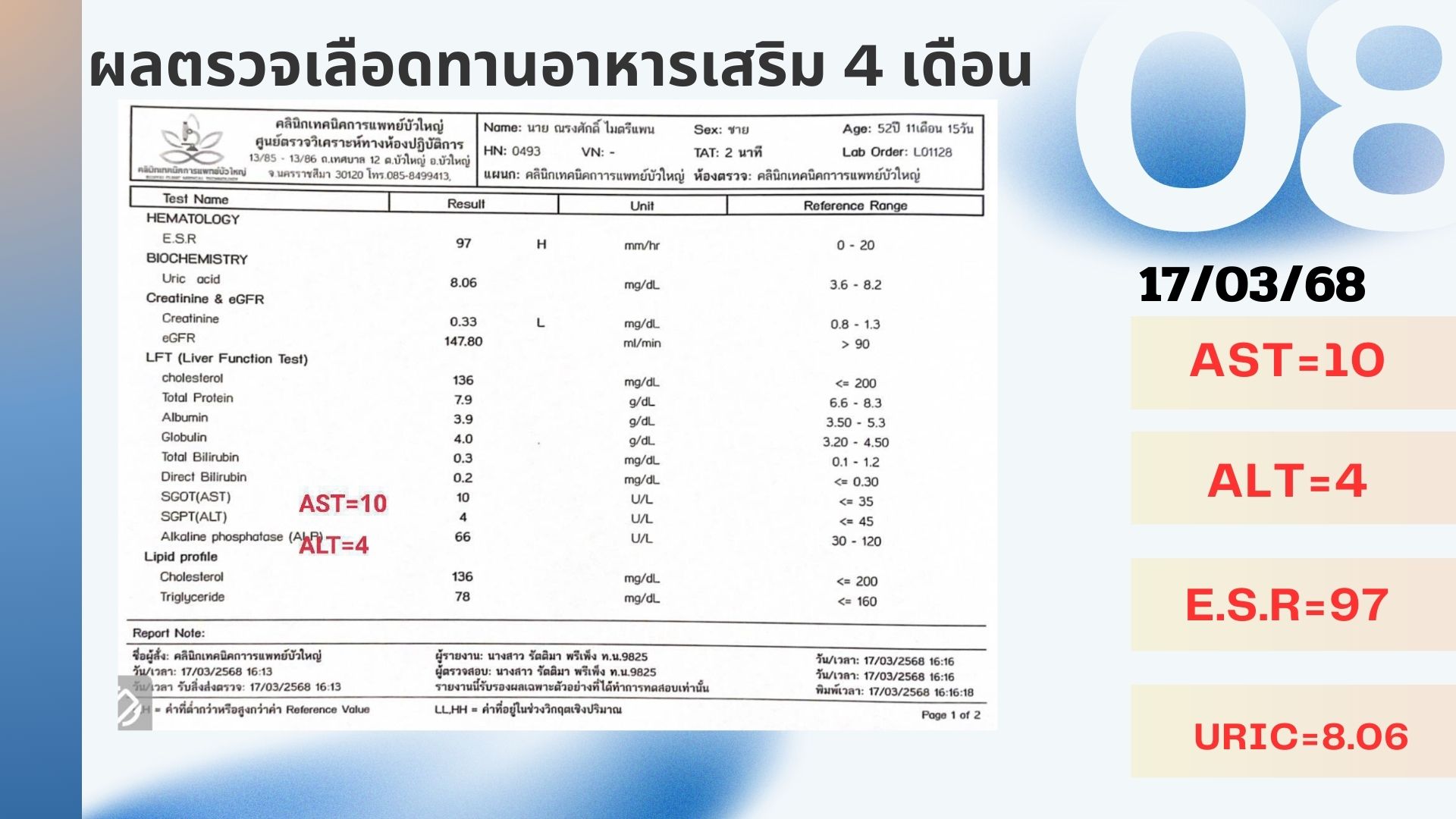 รีวิวผู้ป่วยโรคตับแข็ง