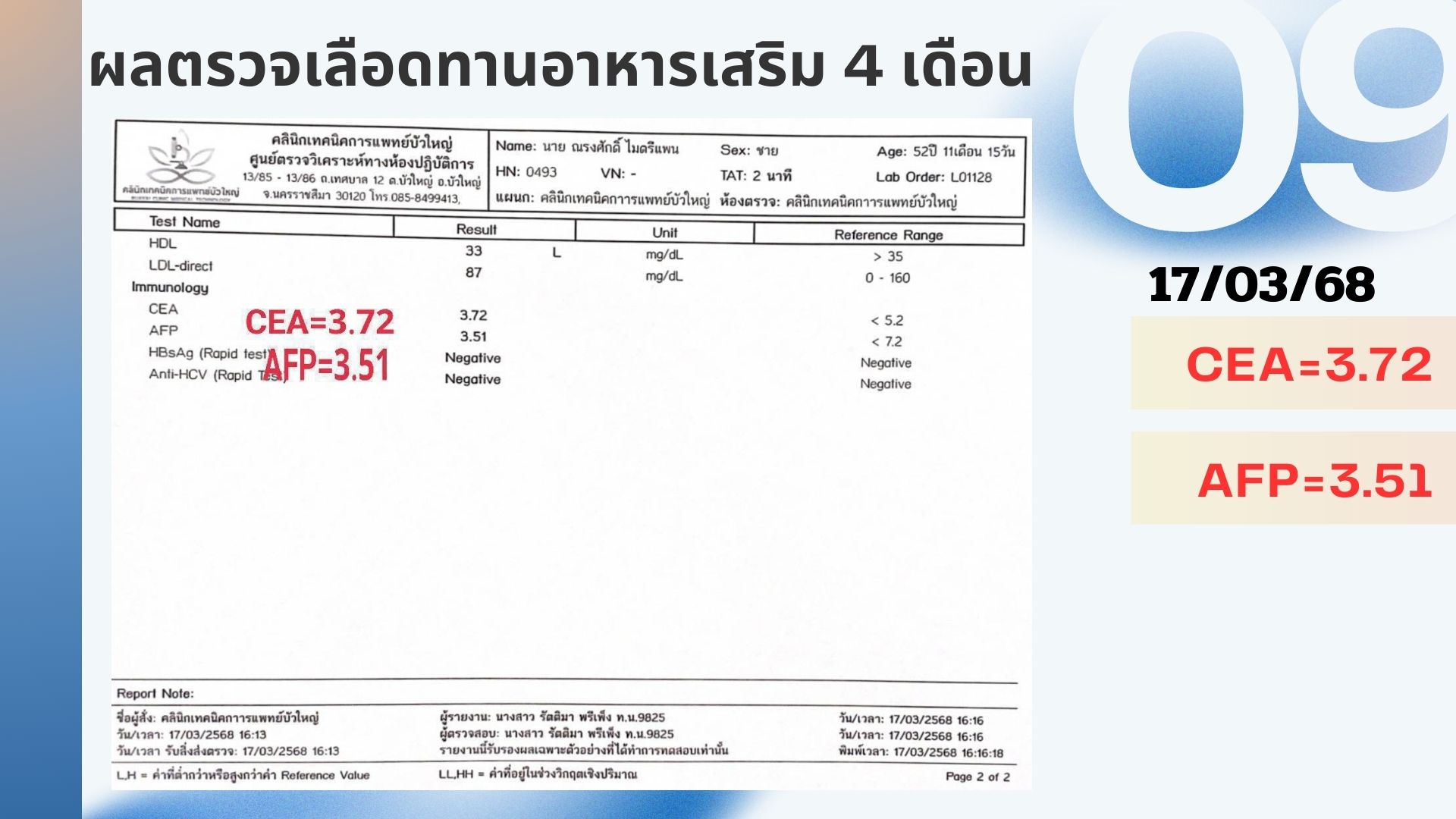 รีวิวผู้ป่วยโรคตับแข็ง